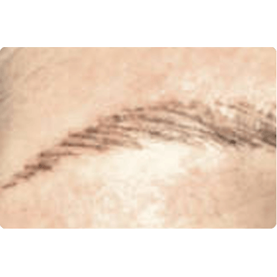 COSMETIC TATTOOING